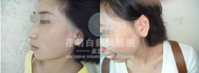 白癜风复发扩散、久治不愈的“三宗罪”