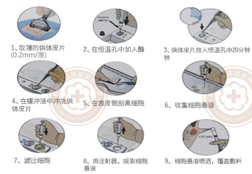 攻克白癜风治疗新高度,大小白斑高效同治