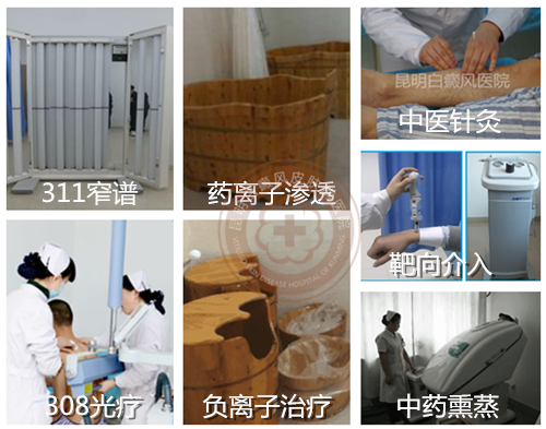 单一抹药难见效,推荐308光疗直达白斑病灶!